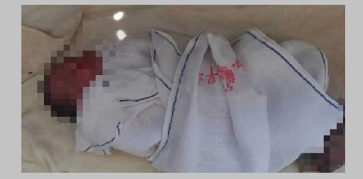 Bayi bertali pusat ditemukan atas rumput