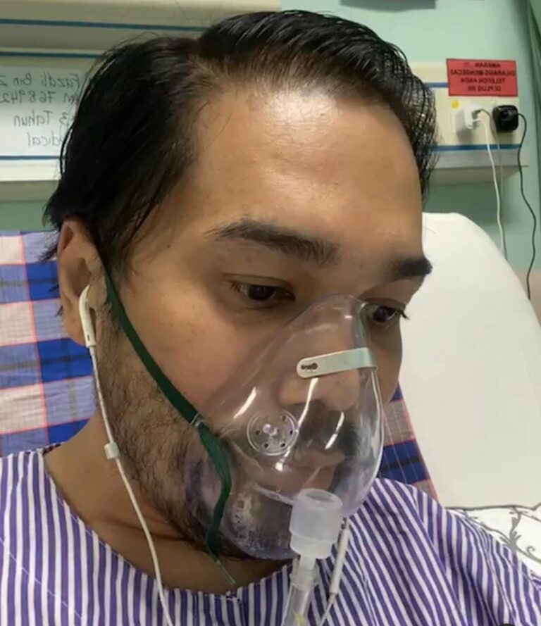 Otak bengkak, kesihatan Fazli Zainal makin pulih
