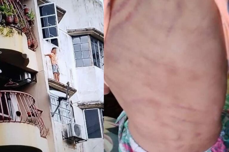 Polis tangkap suami isteri selepas budak didera cuba lari ikut tingkap