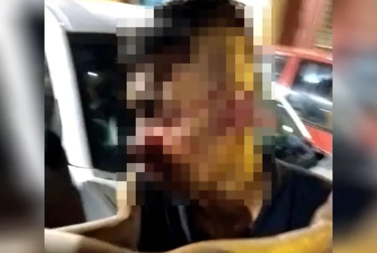 Polis siasat video tular lelaki parah dipukul 2 lelaki