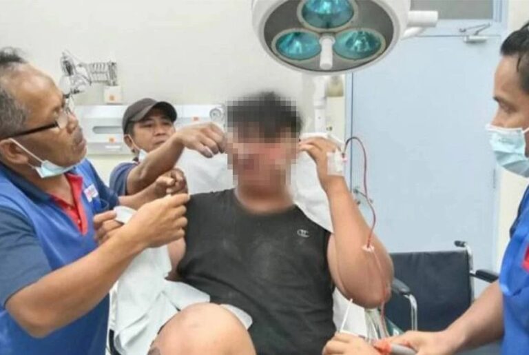 Remaja tercucuk anak panah di hidung sewaktu menangkap ikan