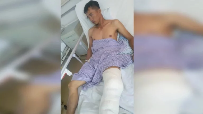 Nelayan cucuk mata buaya bagi selamatkan diri ketika menjala udang